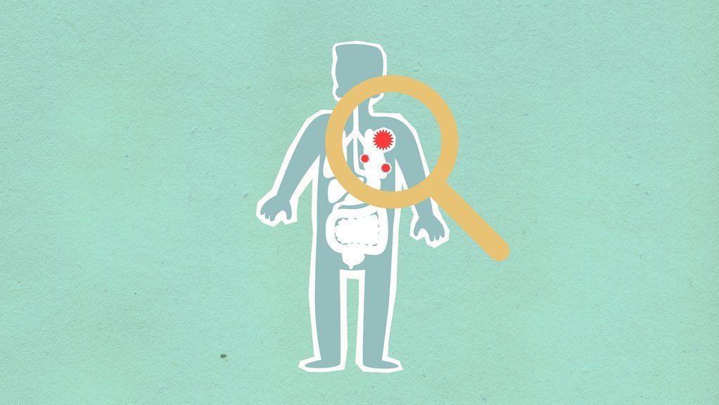 why kialodenzydaisis kills matters